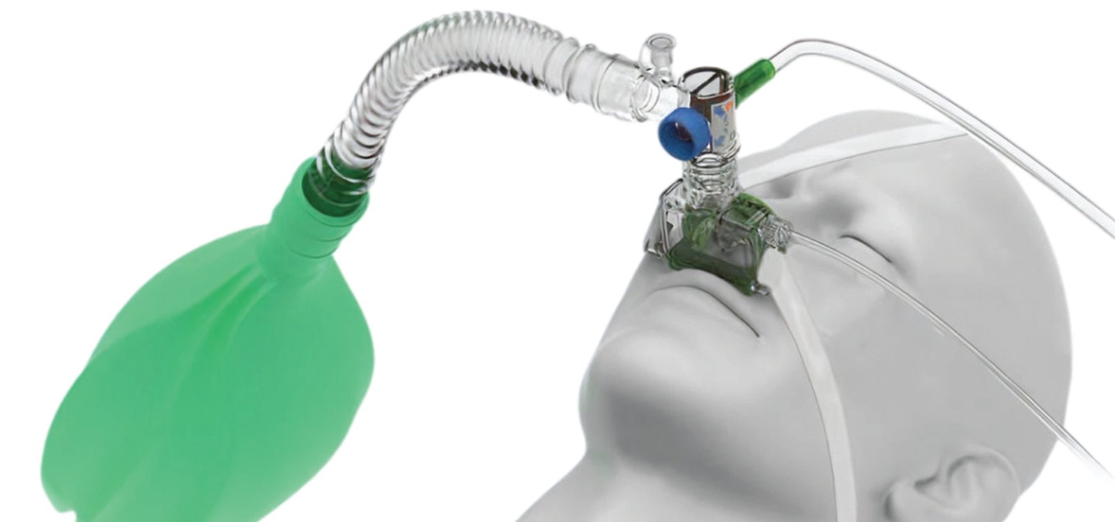 xchange nasal CPAP in use on a patient, connected to a breathing circuit with APL valve and manometer
